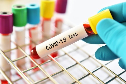 ประเภทใหม่ COVID-19 รีเอเจนต์ทดสอบการวินิจฉัยอย่างรวดเร็วในสิงคโปร์